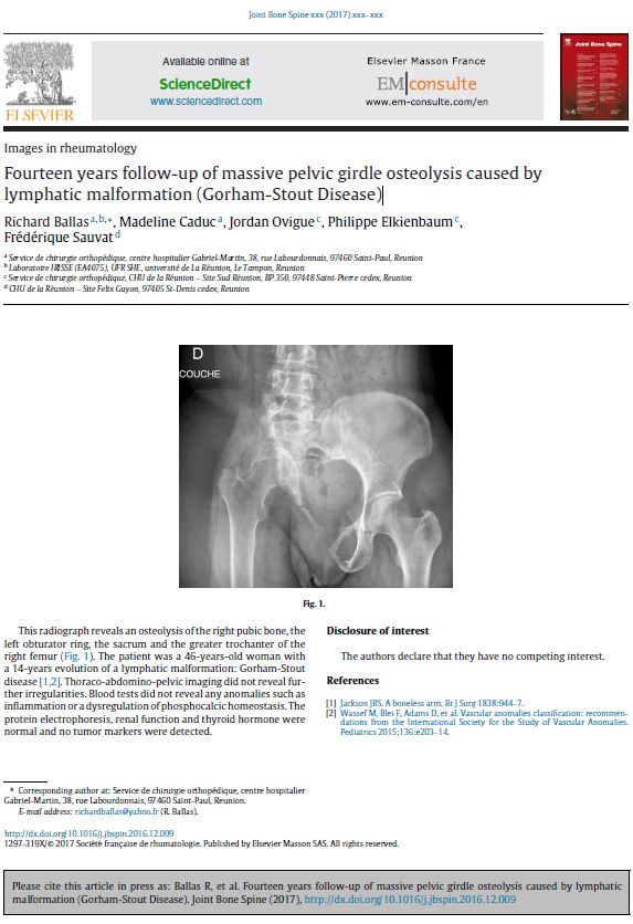Ballas-JBS-2017-Fourteen years follow-up of massive pelvic girdle osteolysis caused by lymphatic malformation
